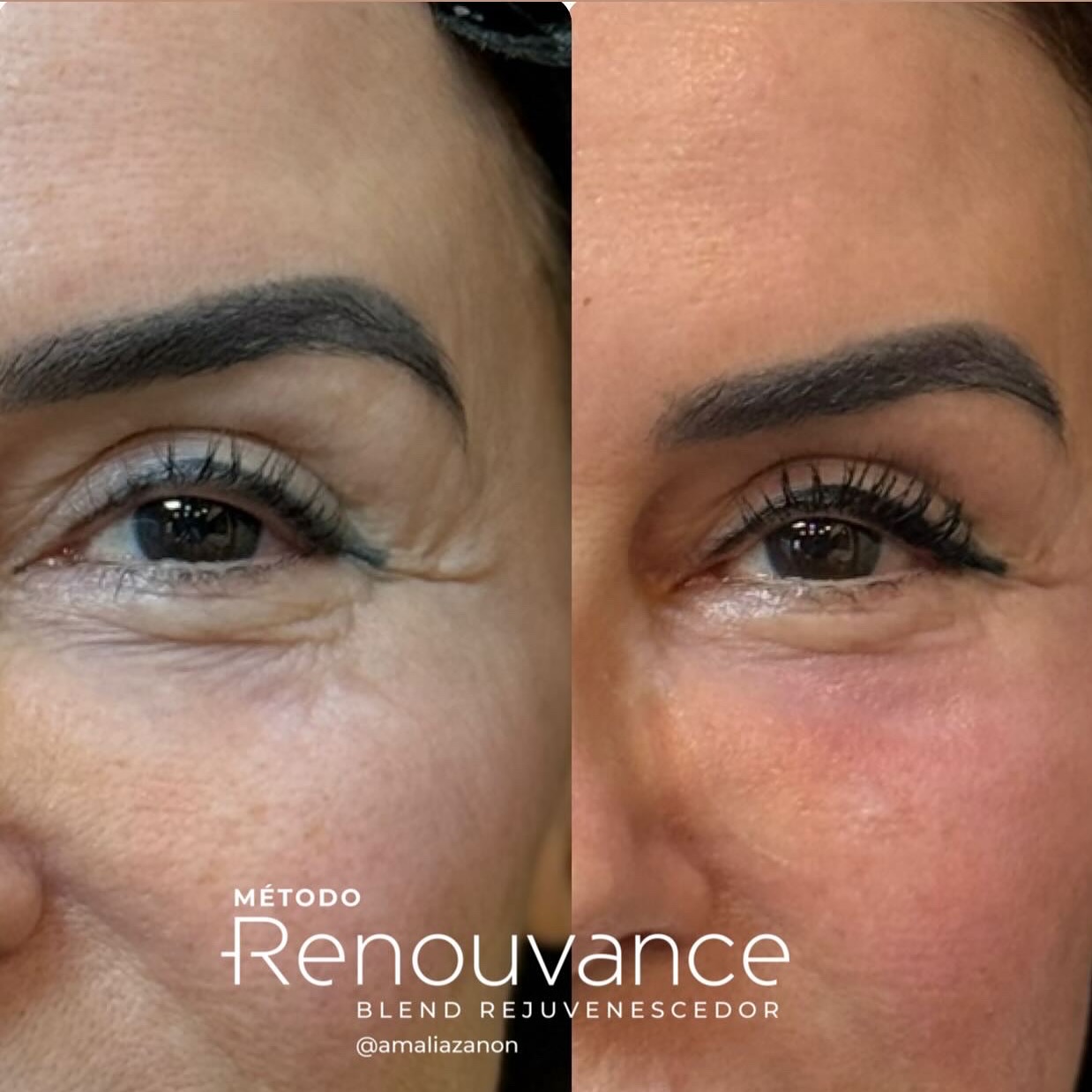 497193048_18499037215007218_1062261585639824473_n