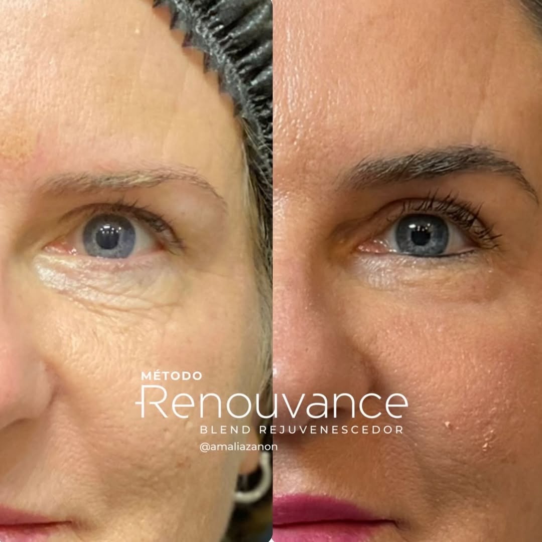 498312399_18500520343007218_6021783640755386424_n