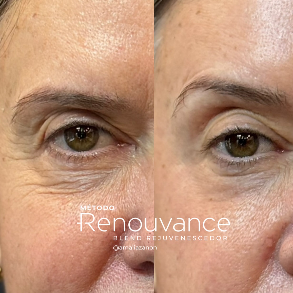 501659810_18502104727007218_496698123443878529_n (1)