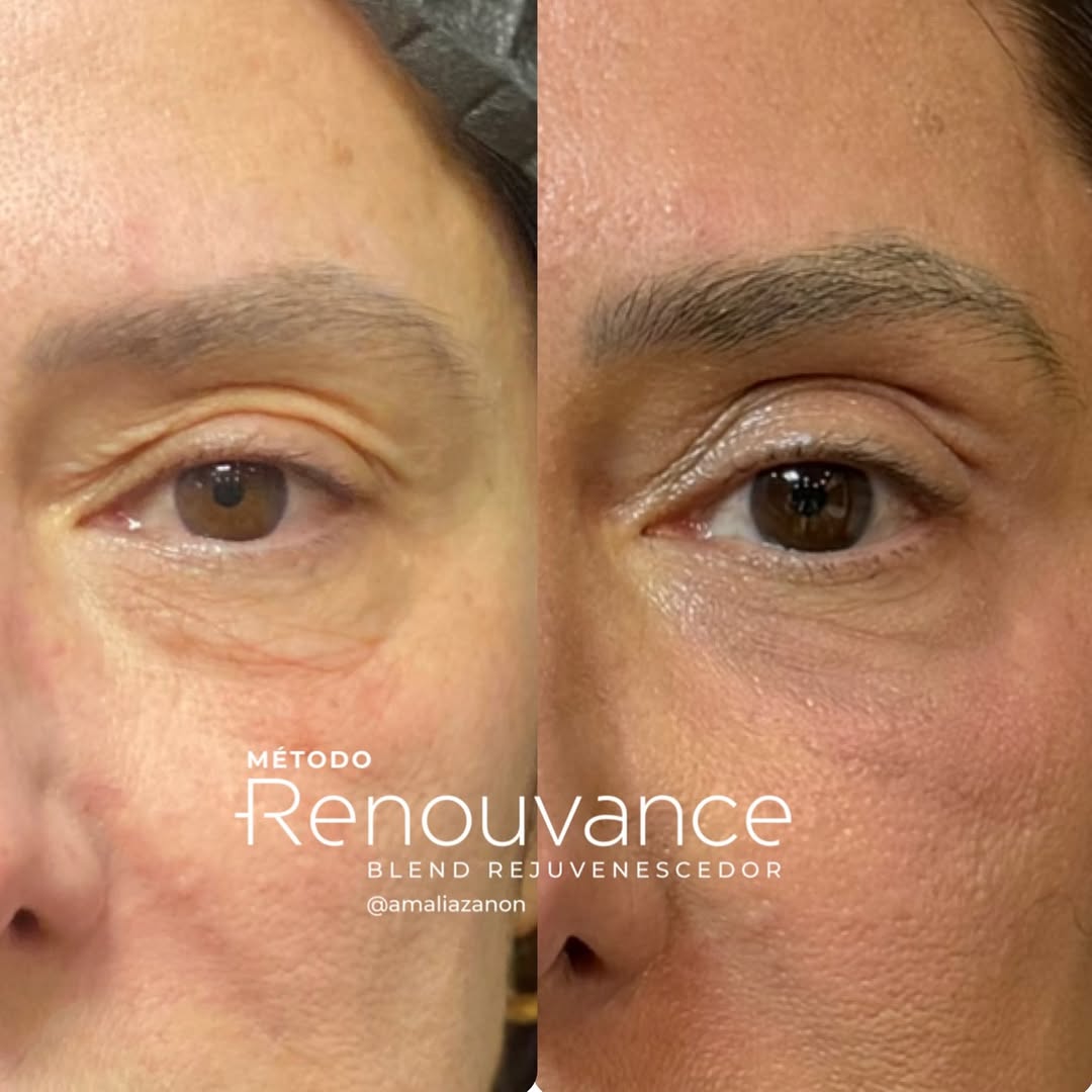 502742074_18502857262007218_7017377939232892895_n