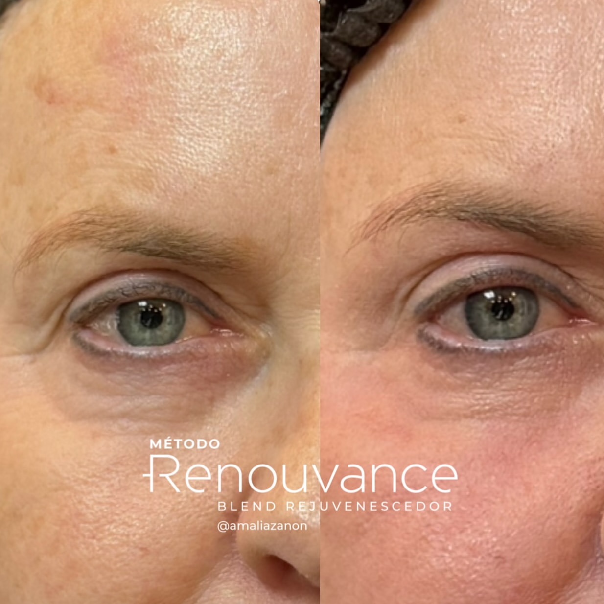 502742076_18502855783007218_6930761392899141485_n